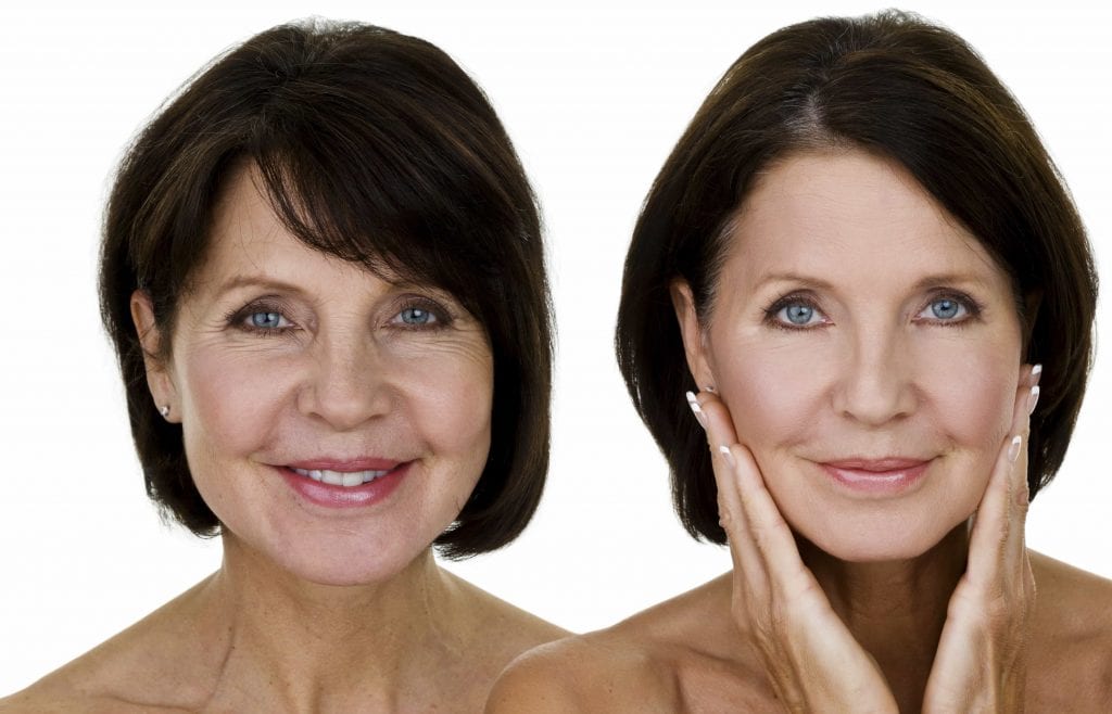 before and after cosmetic procedures